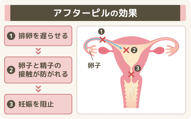 アフターピルの効果