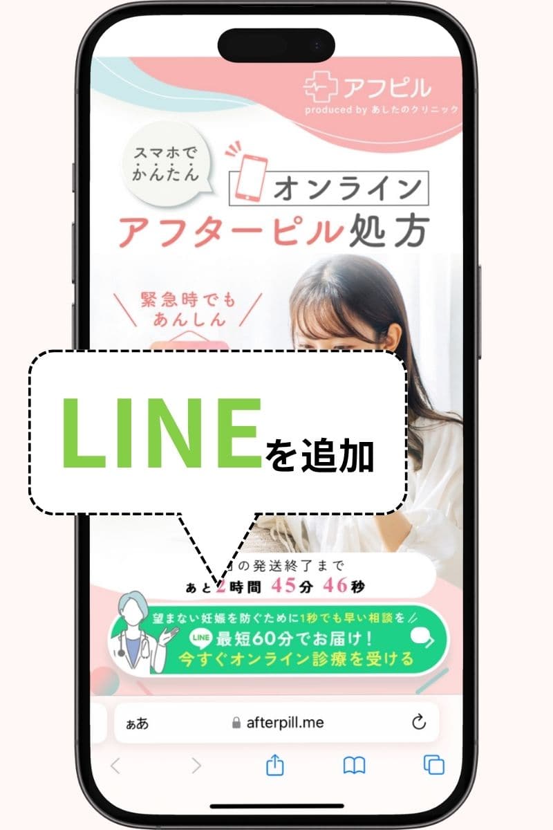 アフピル