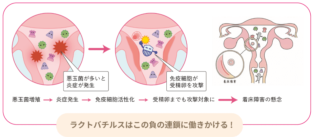 子宮内フローラの妊娠・出産への影響報告データ